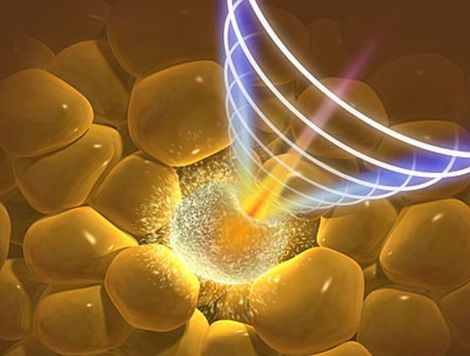 [Image: bung-c_zps999420d9.jpg]